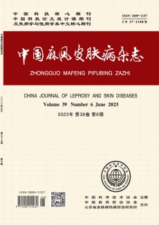 中国麻风